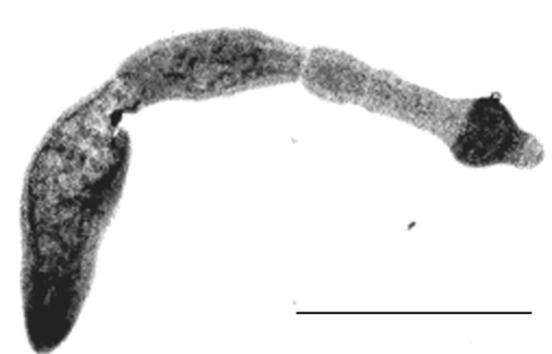Fichier:Echinococcus.png